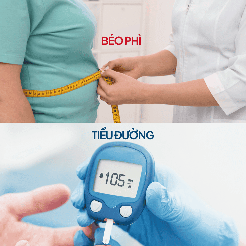 Mối quan hệ giữa Đái tháo đường và Béo phì. Hiểu để kiểm soát